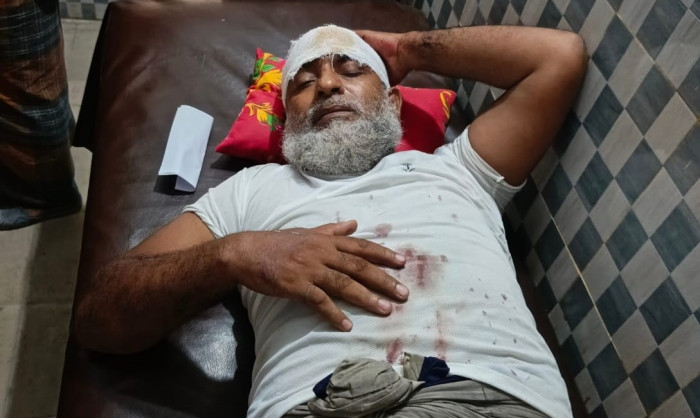 জমি নিয়ে বিরোধে অতর্কিত হামলা, আহত ১