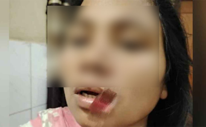 ছবি : সংগৃহীত